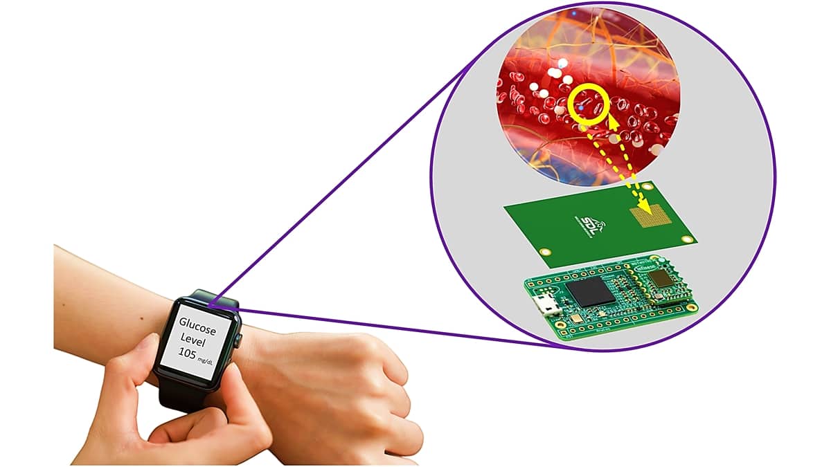 Needleless Glucose Monitor